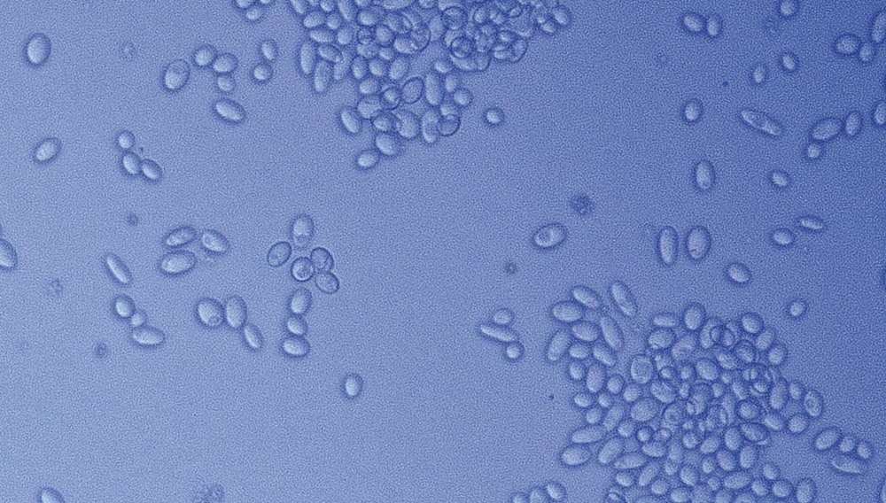 Microscopic image of Saccharomyces cerevisiae recte diastaticus