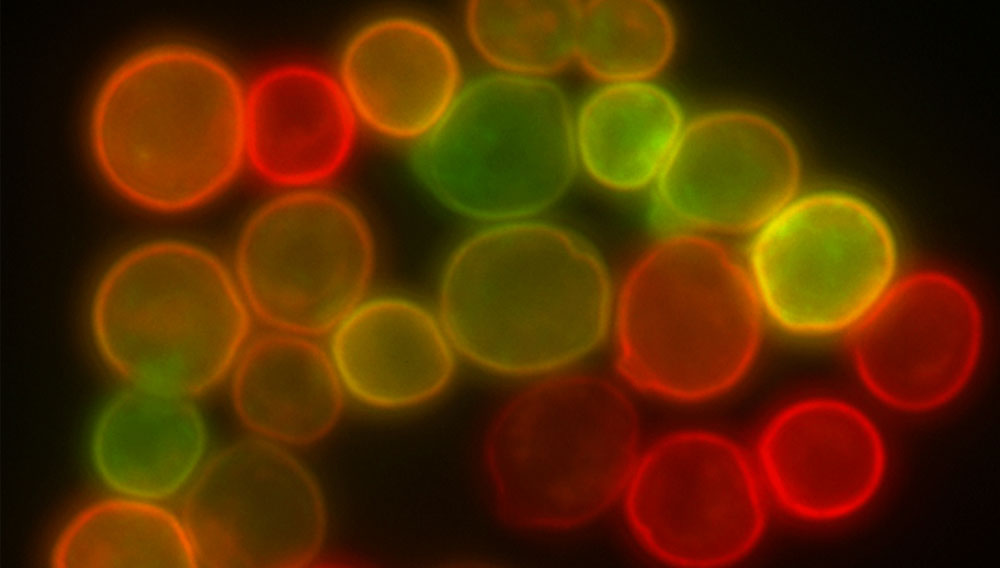 Colour-stained yeast cell membrane proteins (Photo: Masur, CC BY-SA 3.0 , via Wikimedia Commons; https://commons.wikimedia.org/wiki/File:Yeast_membrane_proteins.jpg)