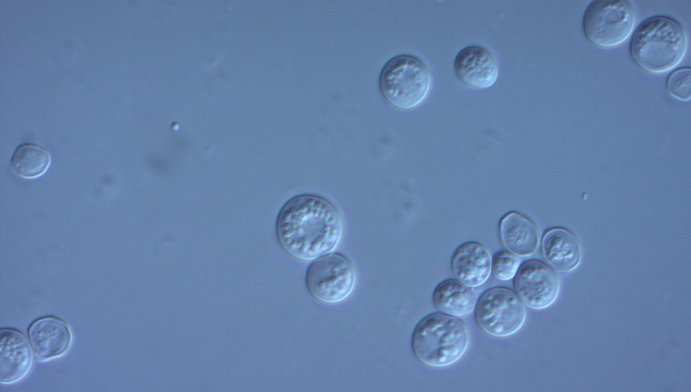 Yeast under the microscope (Photo: Prof. Müller-Schollenberger, HSWT)