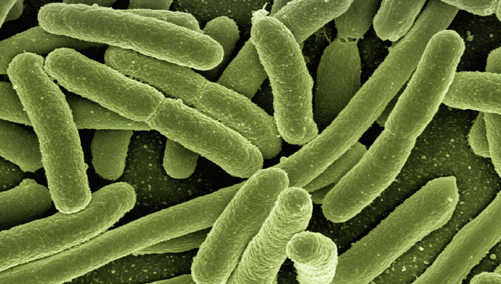 Coliform bacteria (Photo: Gerd Altmann on Pixabay)