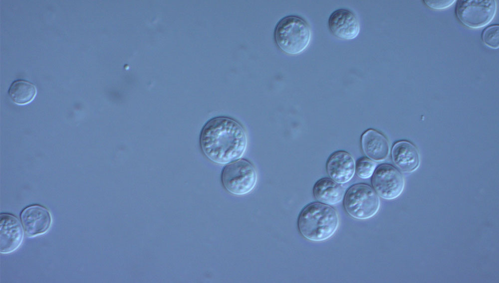 Yeast cells under the light microscope (Photo: Prof. Müller-Schollenberger/HSWT)
