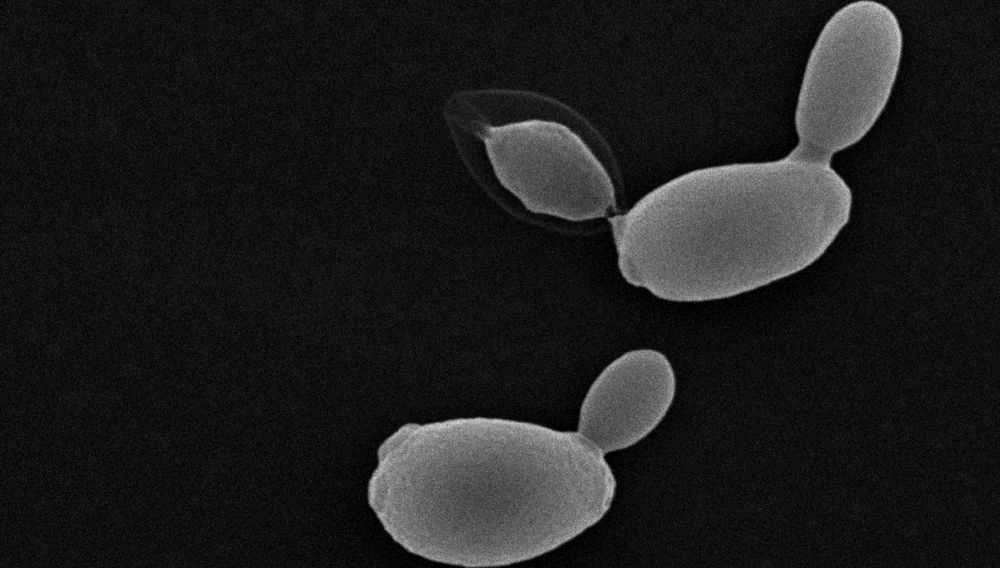 Scanning electron micrograph of cells of a bottom-fermenting yeast