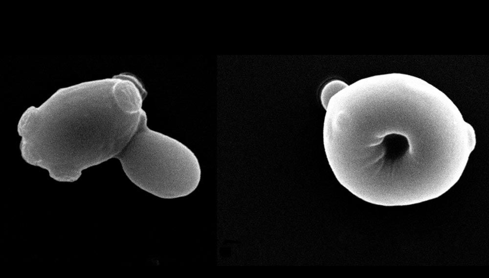 Electron microscopic image of curiously shaped yeast cells