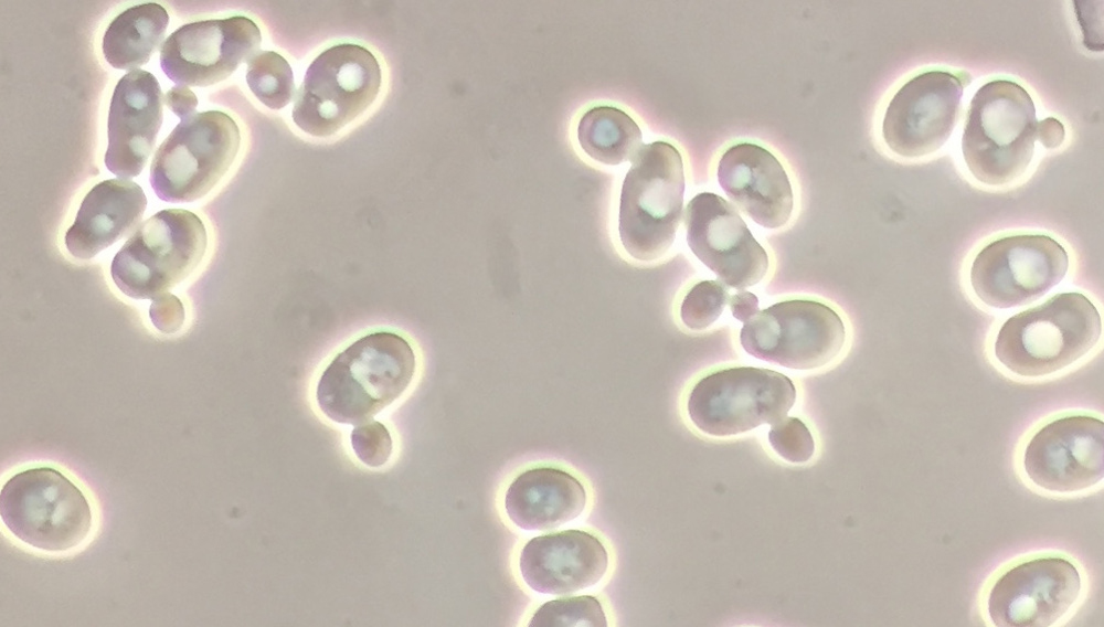 Yeast – a crucial factor in achieving excellent beer quality