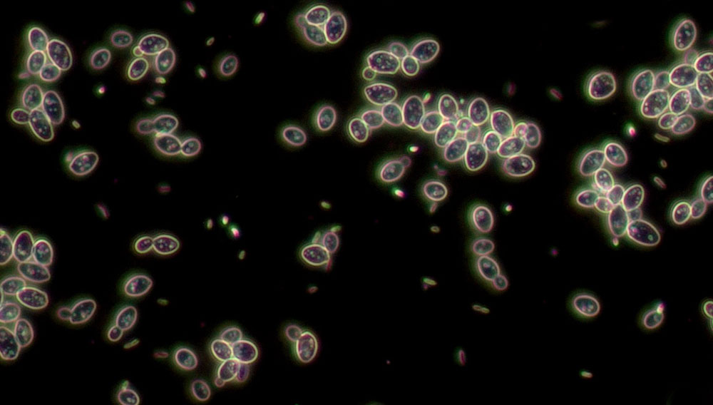 Yeasts (Source: VLB)
