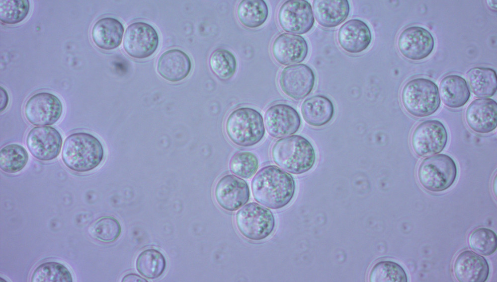 Yeast cells under a microscope