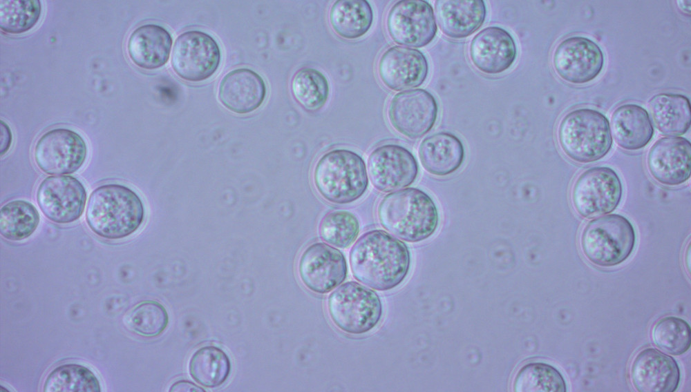 Yeast (Photo: Volker Müller-Schollenberger, Hochschule Weihenstephan-Triesdorf)