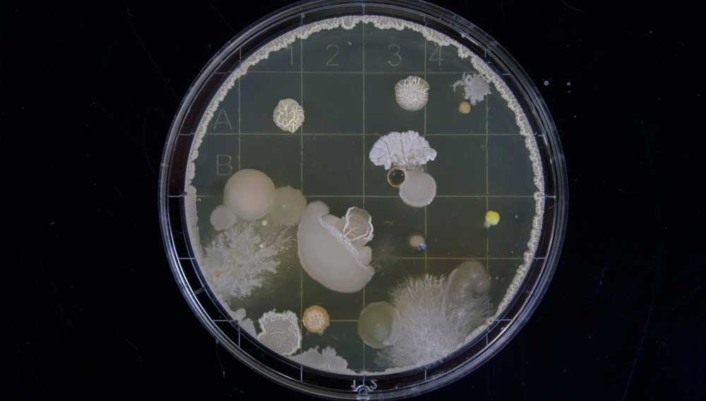 Petrischale mit Bakterienkolonien (Foto: Michael Schiffer on Unsplash)