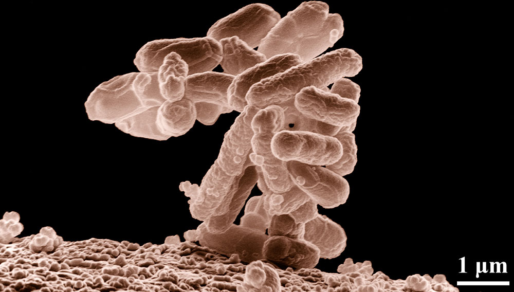 Escherichia coli unter dem Elektronenmikroskop in 10000-facher Vergrößerung