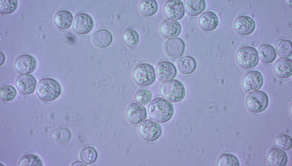 Hefezellen unter dem Mikroskop (Foto: René Rehorska/ FH Joanneum) Hefezellen unter dem Mikroskop (Foto: René Rehorska/ FH Joanneum)
