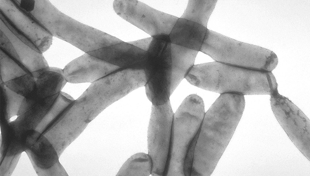Mikroskopisches Bild von Legionella pneumophila
