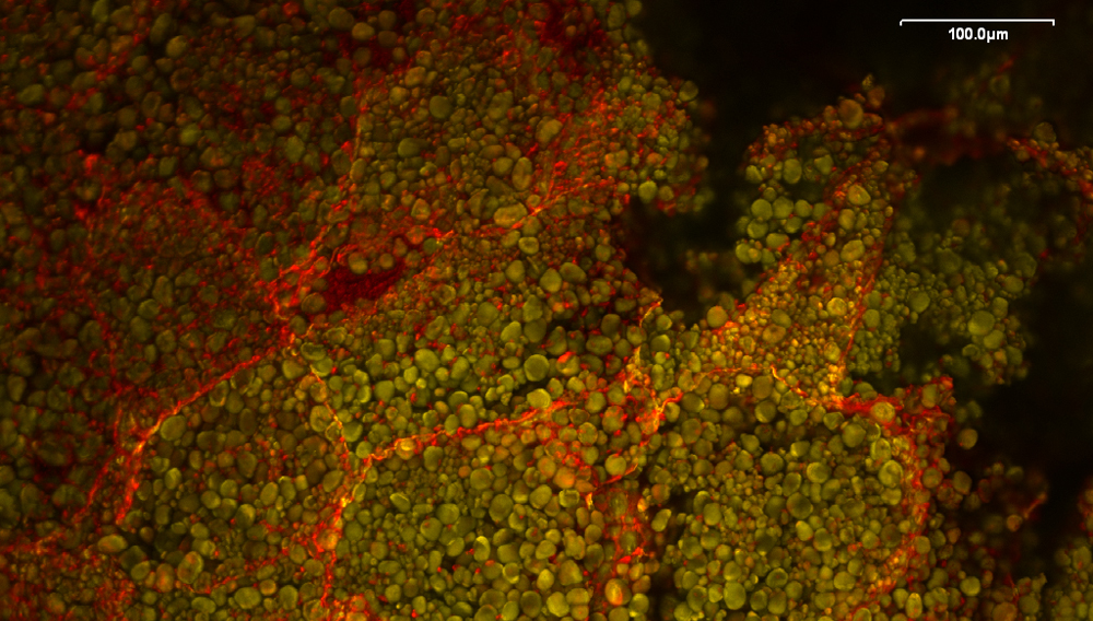 Mais-Rohfrucht, Endosperm Stärkekörner eingebettet in Proteinmatrix; Konfokale Laser-Scan-Mikroskopie (CLSM)