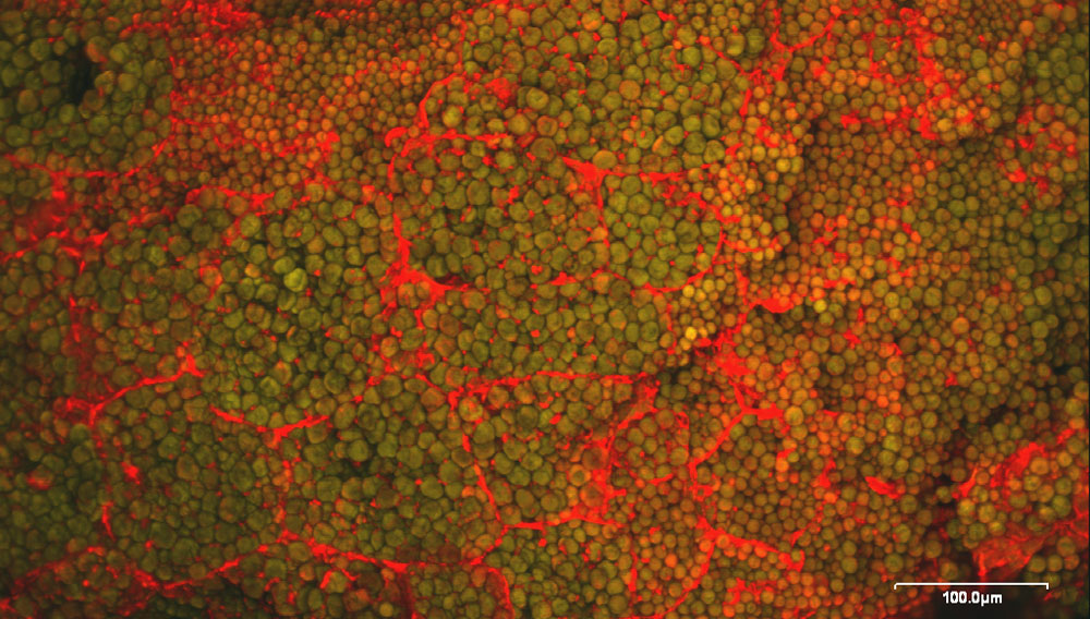 Maismalzkorn in der Konfokalen Laser-Scan-Mikroskopie (CLSM), zu sehen sind Stärkekörner als grüne Kugeln, eingebettet in einer rot gefärbten Proteinmatrix