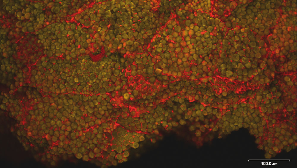Mais-Rohfrucht, Endosperm: Stärkekörner (grün) eingebettet in einer roten Proteinmatrix; Konfokale Laser-Scan-Mikroskopie (CLSM)