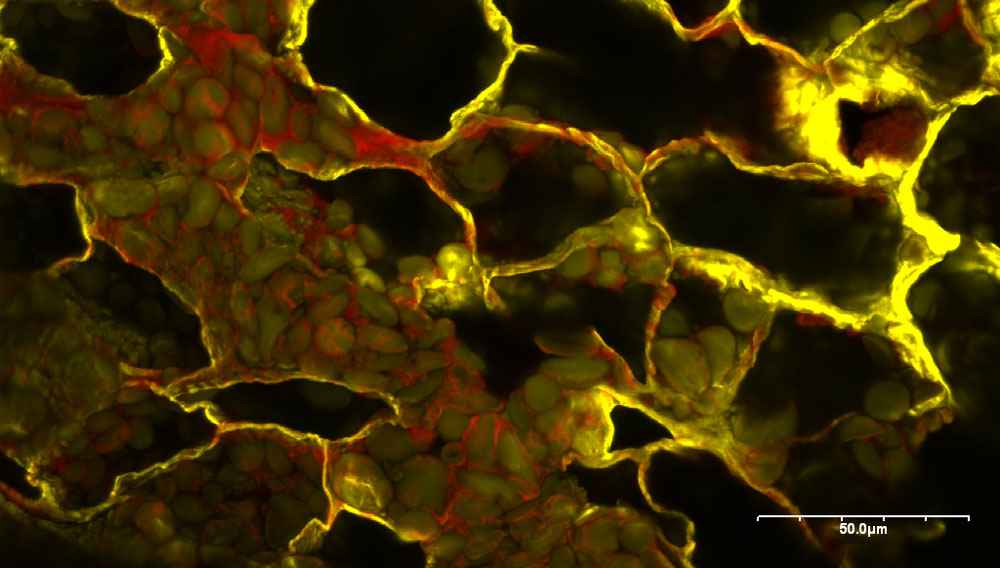 Dinkel (Rohfrucht) in der konfokalen Laser-Scan-Mikroskopie (CLSM); im Bild zu erkennen sind die Blattkeimanlage, das Aufsaugepithel und das Endosperm