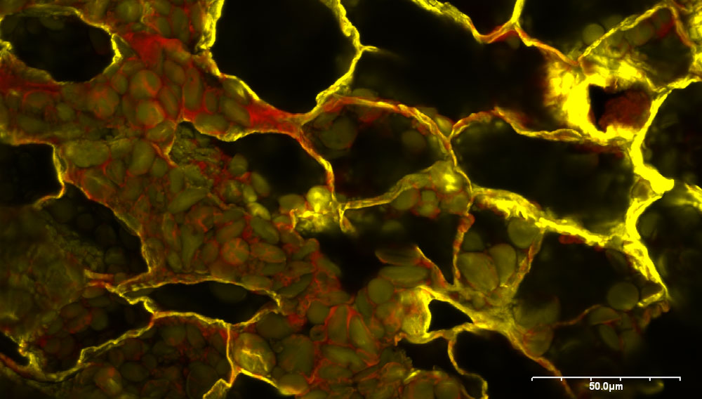 Dinkel (Rohfrucht) in der konfokalen Laser-Scan-Mikroskopie (CLSM); im Bild zu erkennen sind Endospermzellen mit Stärkekörnern (grün) und Proteinen (rot)
