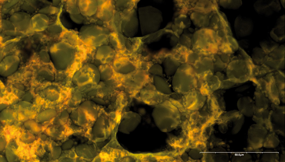 Weizenrohfrucht, Zentrale Endospermzellen mit eingelagerten Stärkekörnern; Konfokale Laser-Scan-Mikroskopie (CLSM)