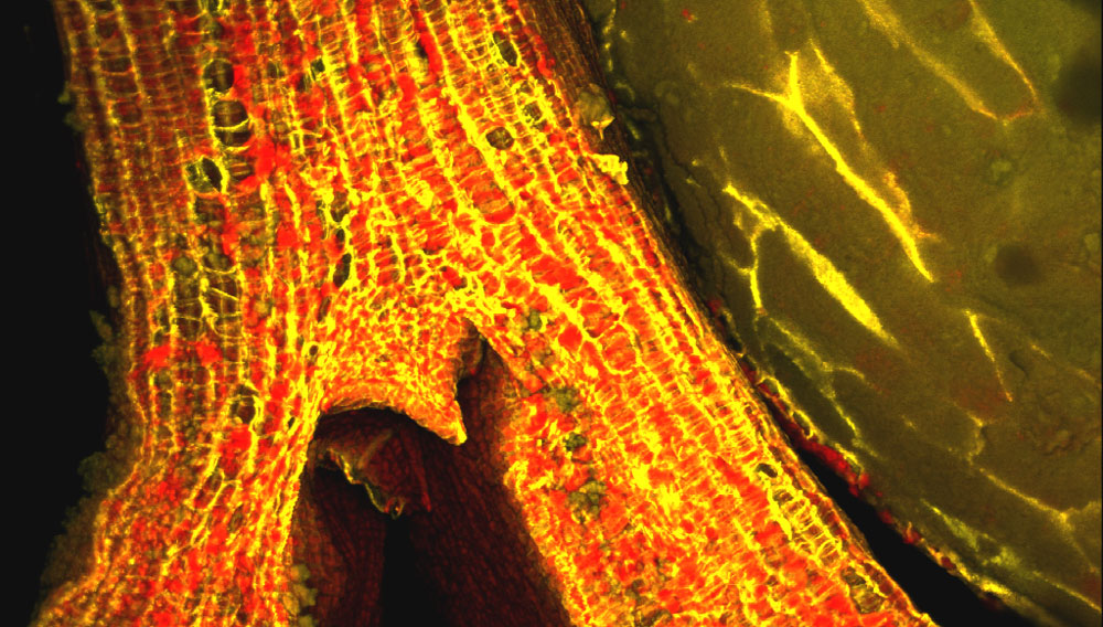 Quinoa-Rohfrucht, Sprossknospe und Keimblätter; Konfokale Laser-Scan-Mikroskopie (CLSM)